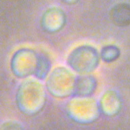 Saccharomyces cerevisiae #1