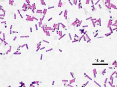 Bakterije Bacillus subtilis obojane po Gramu